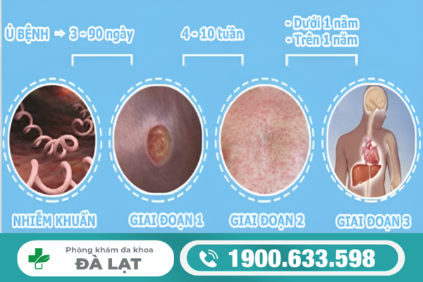 Hình ảnh minh họa